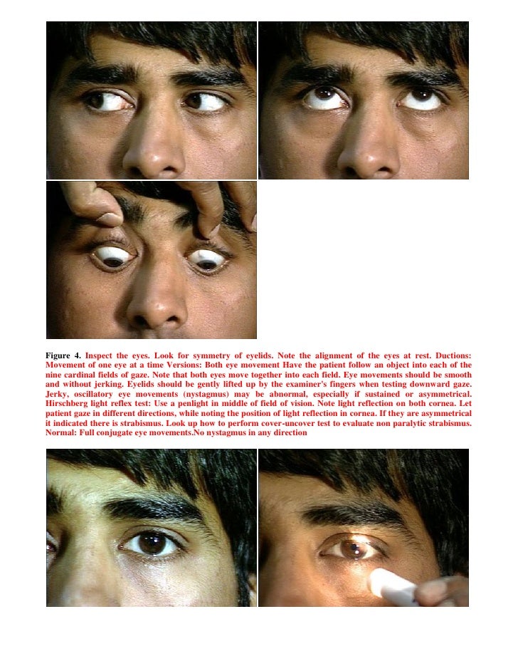 Glassy eyed facial expression with presyncope Teen porn star list